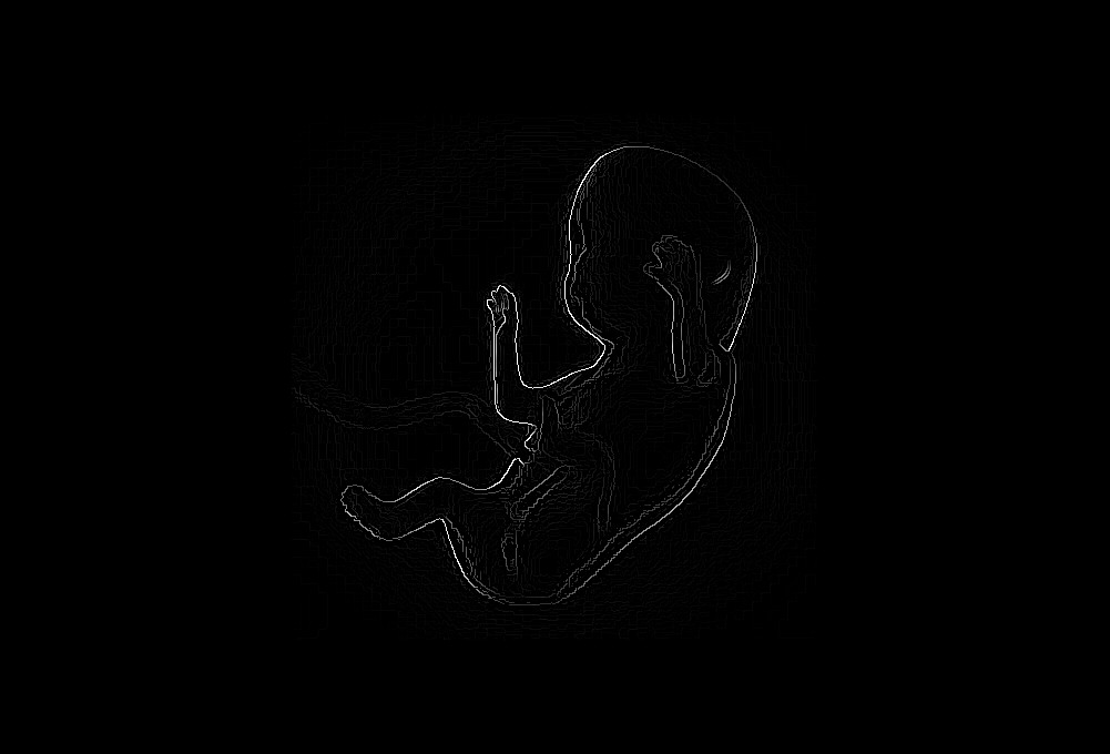 Cover-billede af foster